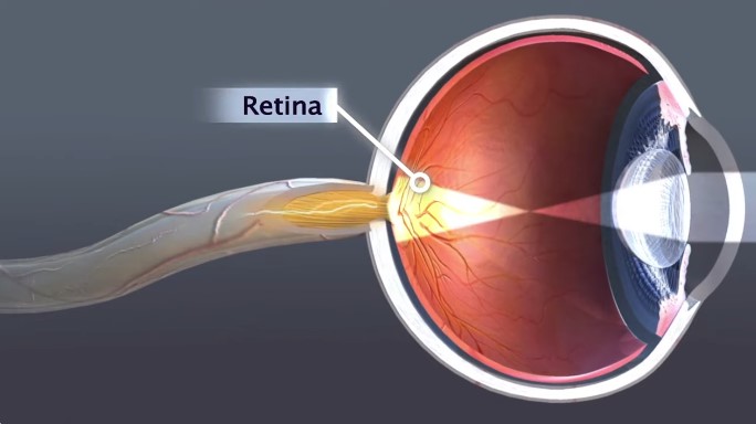 Common Eye Conditions